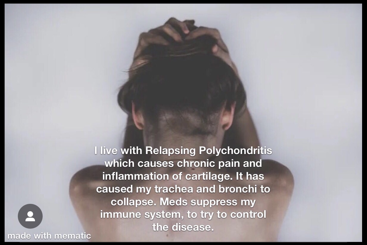 Photograph of the back and shoulders of a white woman with brown hair. She holds on to the top of her head as if she is in pain. White text overlays the image and reads: I live with Relapsing Polychondritis which causes chronic pain and inflammation of cartilage. It has caused my trachea and bronchi to collapse. Meds suppress my immune system to try to control the disease.
